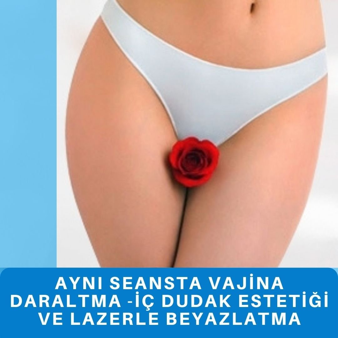 İstanbul vajina daraltma fiyatı vajina daraltma ameliyatı fiyatları